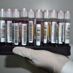 Ministério eleva para 69 anos a idade máxima para doação de sangue -  Amostras para realizacção do teste ácido nucléico (Foto: Ascom/FSPH)